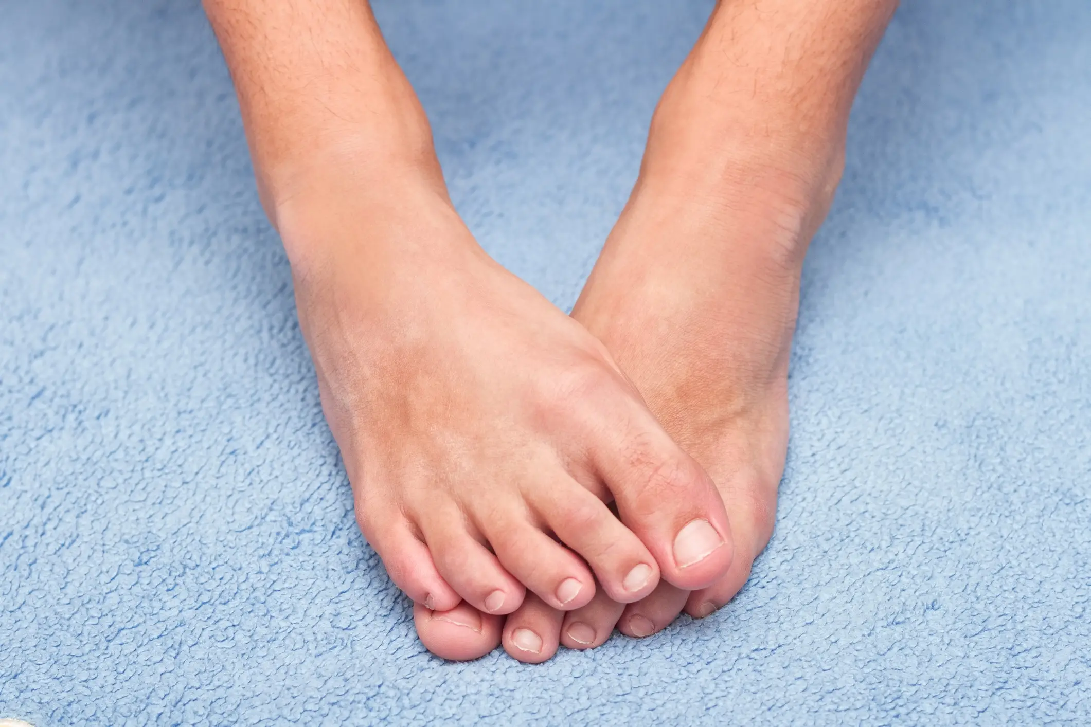 You can learn a lot about your health from your toenails (Getty Stock Images)