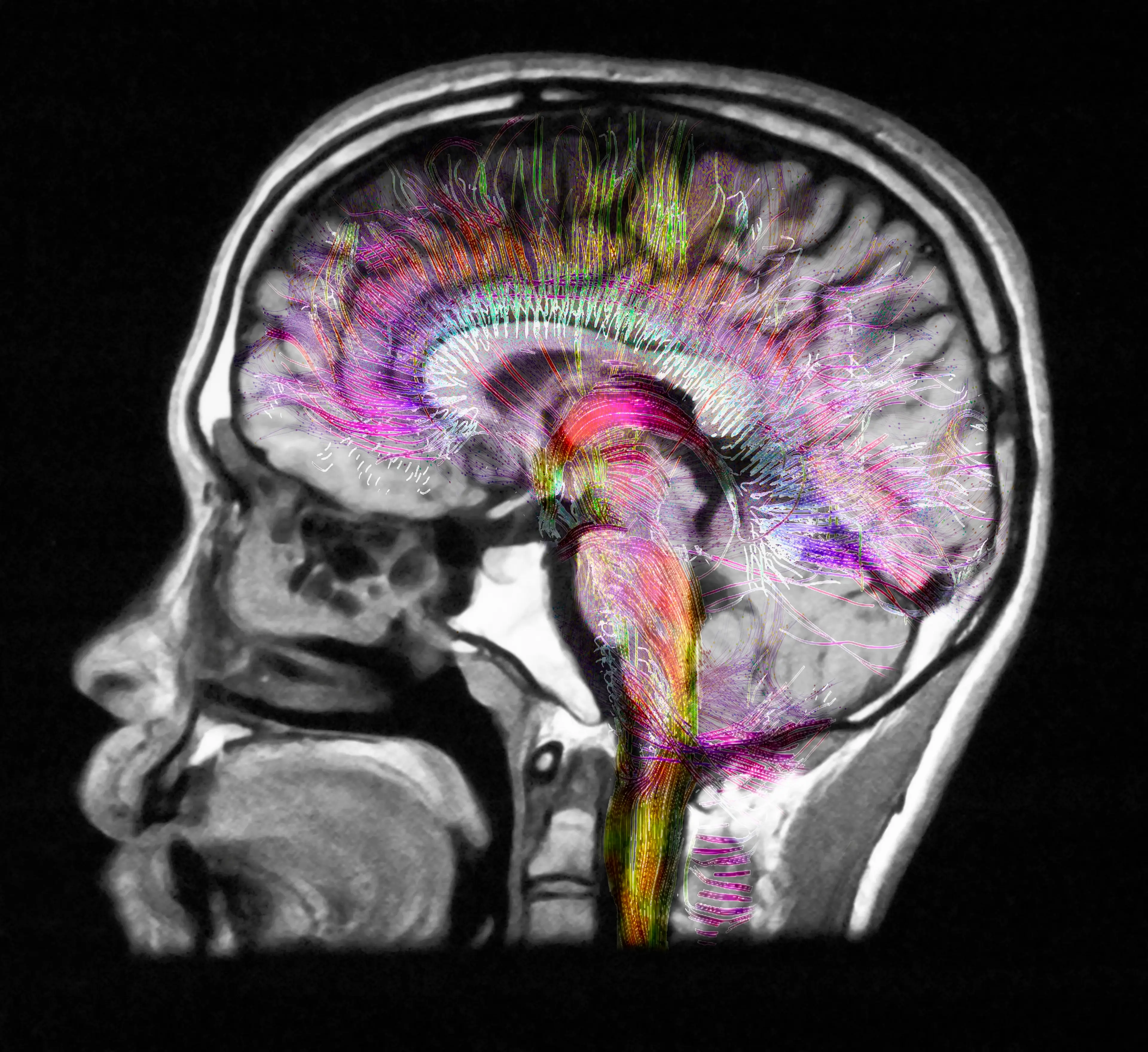 The new research suggests that psychedelics can cause anatomical changes in the brain, affecting well-being (Getty Stock Image)