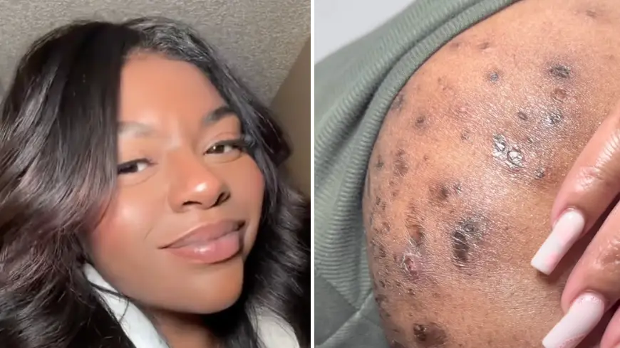 Instagram/@socialcydd