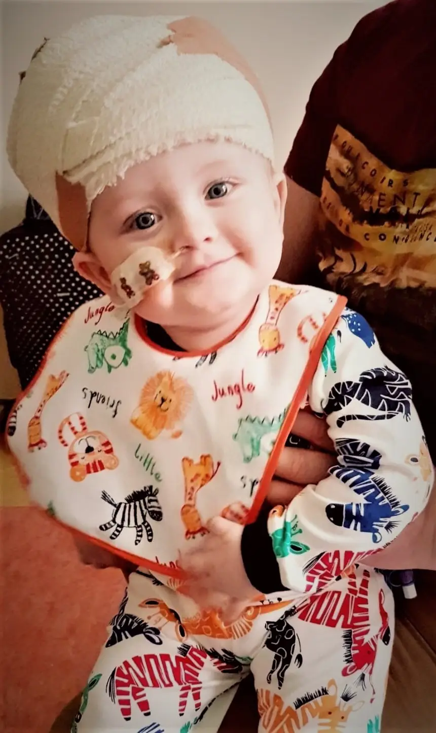 Oscar, now five, has had to undergo 11 surgeries.