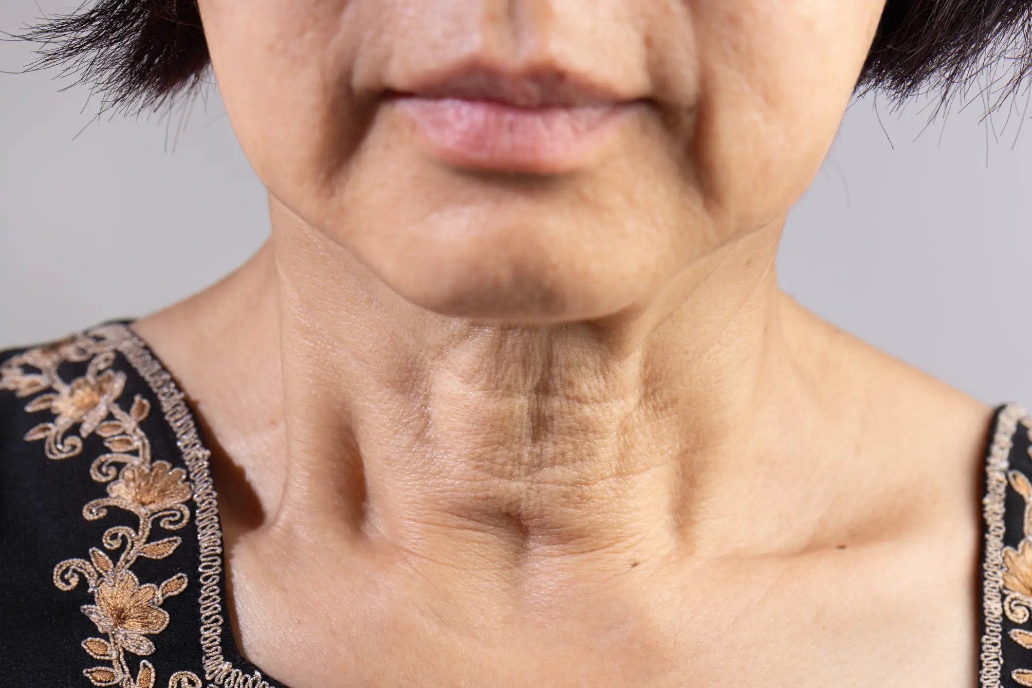 Some using weight loss jabs have complained of sagging skin around their neck (Getty Stock Image)