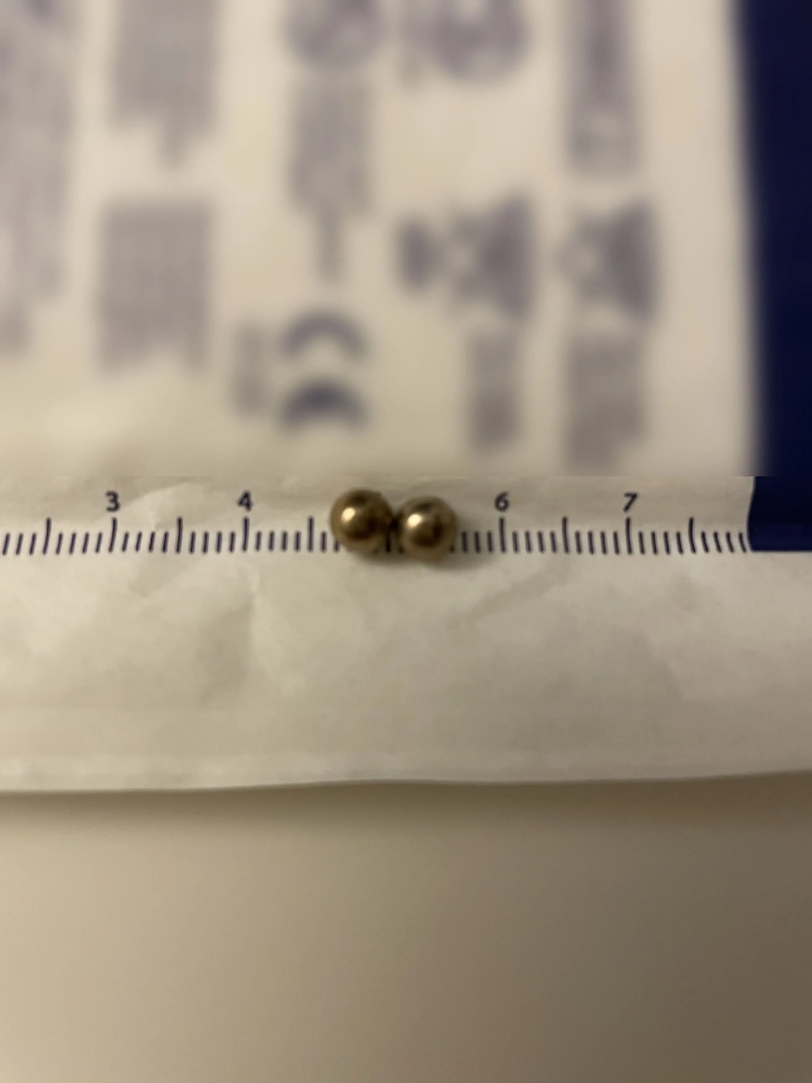 The magnets Falyn swallowed.