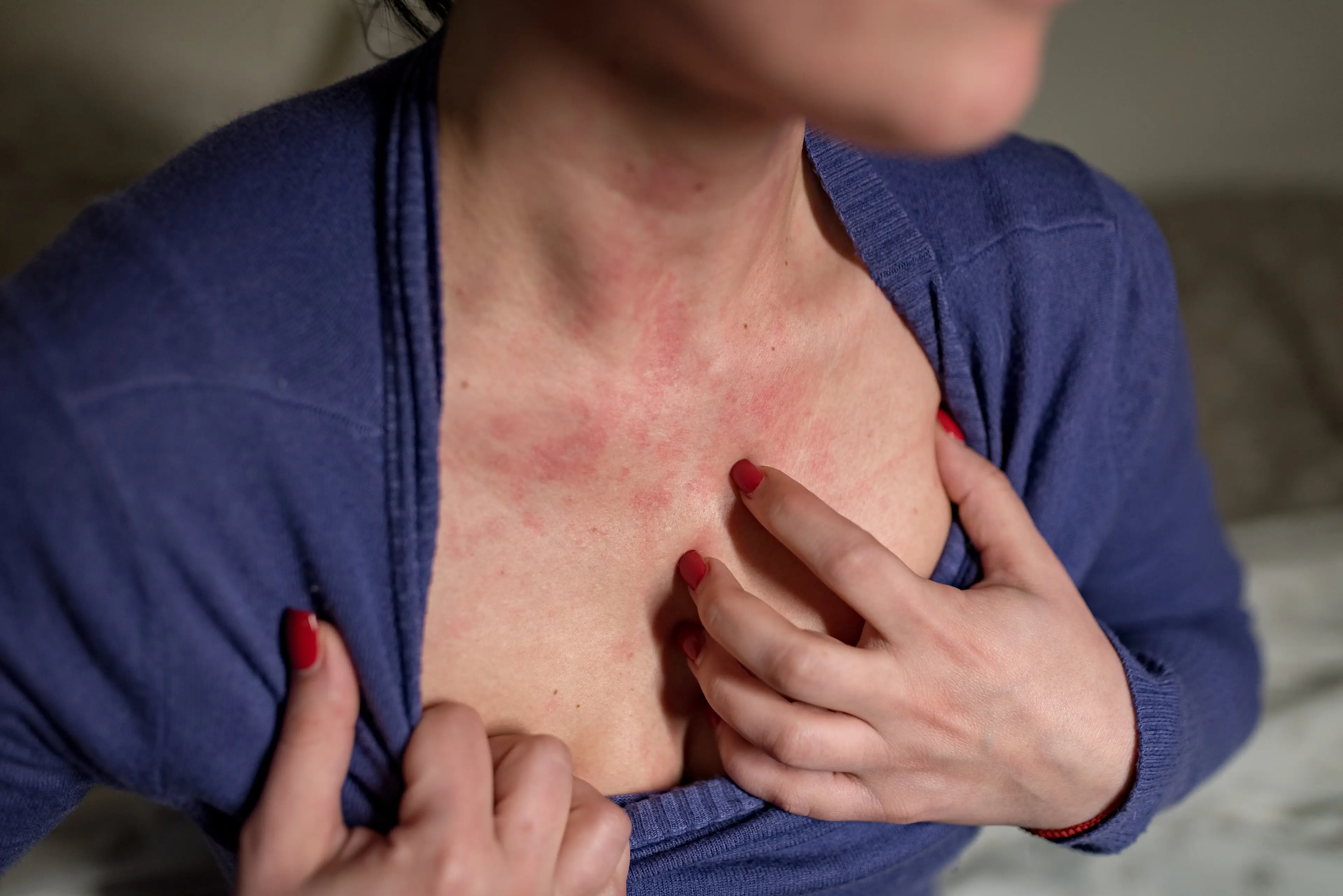 The FDA has warned that use of the recalled product could result in 'life-threatening adverse events' (Getty Stock Images)