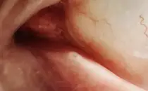 Questions have been raised over these tiny eye holes (Getty Stock Image)