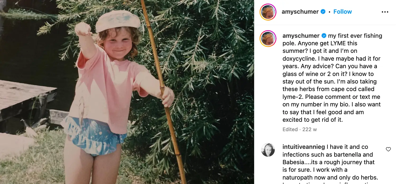 Amy begged her fans for support at the time (Instagram/@amyschumer)