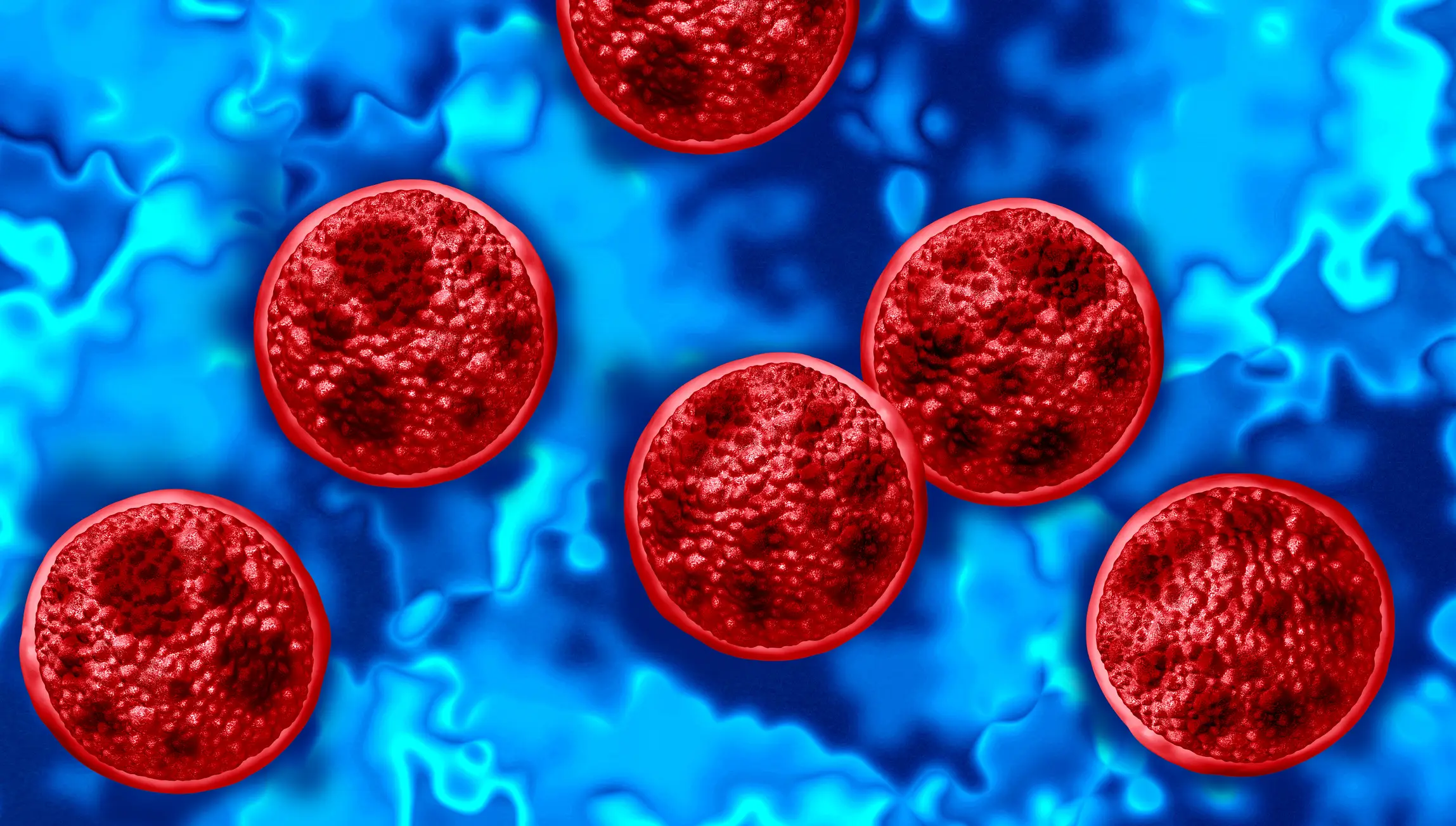 Cyclosporiasis is caused by the Cyclospora cayetanensis parasite (wildpixel/Getty Images)