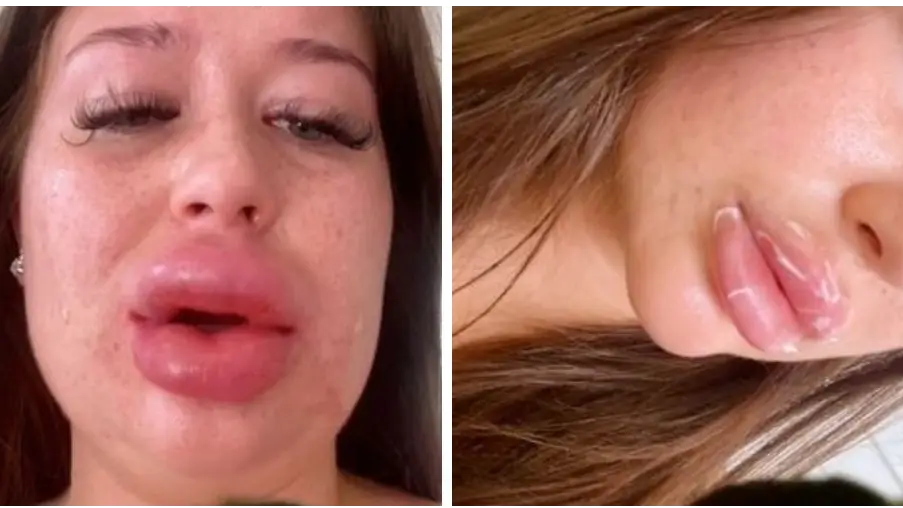 Tiktok/karligardnerxx