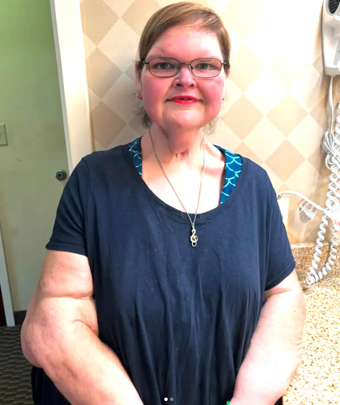 Tammy was insecure about the loose skin before she got the procedure done (Instagram/@queentammy86)