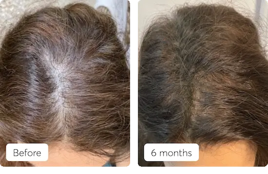 Shoppers have been impressed with their results.