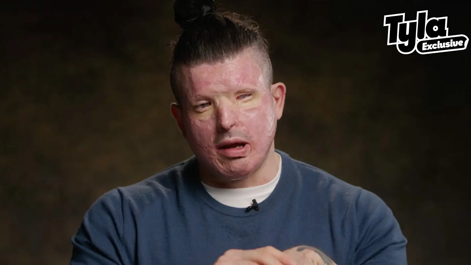 Baby's devastating reaction to seeing dad for first time after acid attack