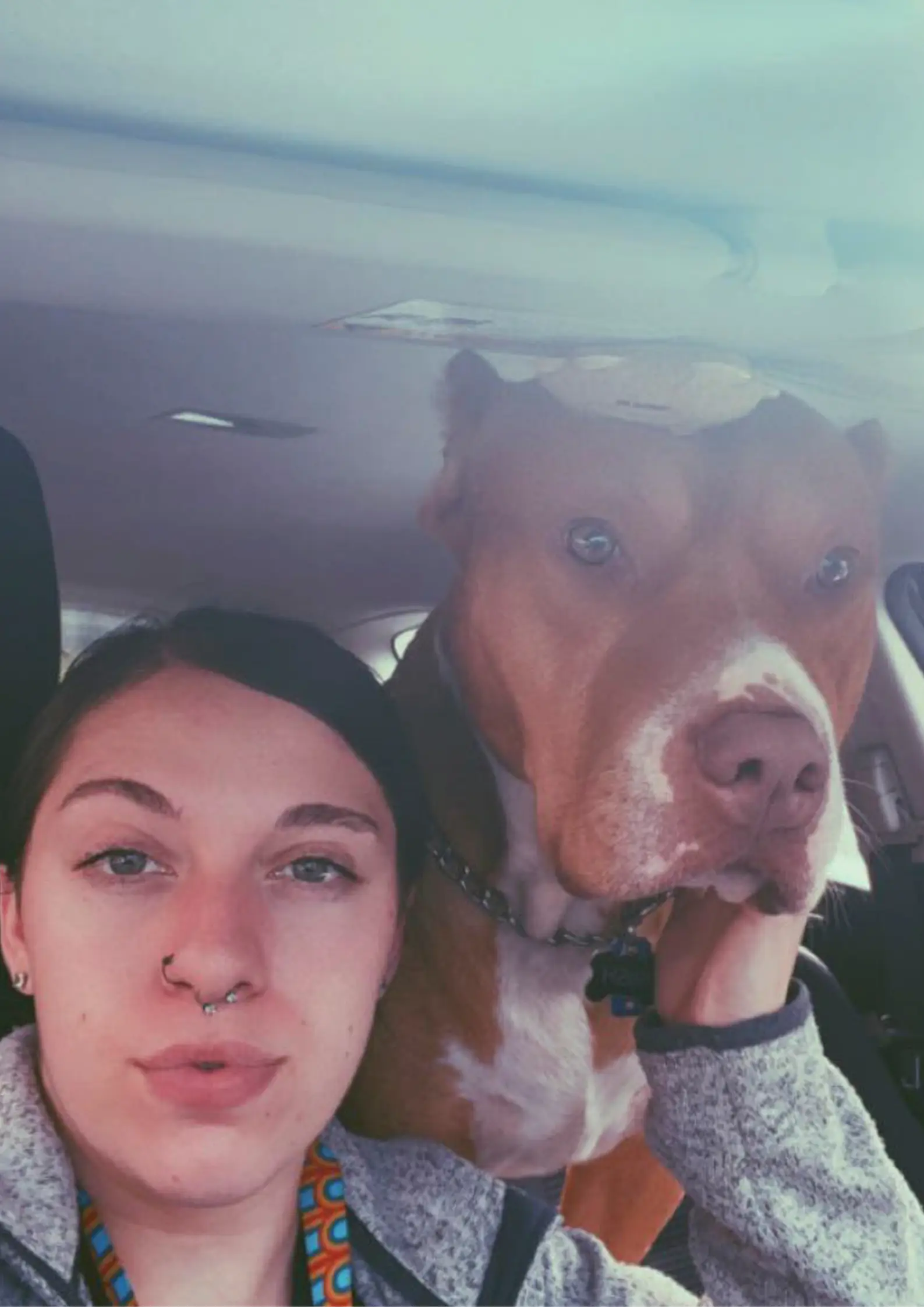 Trinity, 20, was attacked by her dad's rescue dog last September.