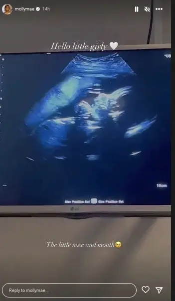 Regardless, Molly-Mae is clearly overjoyed to be welcoming her first child.