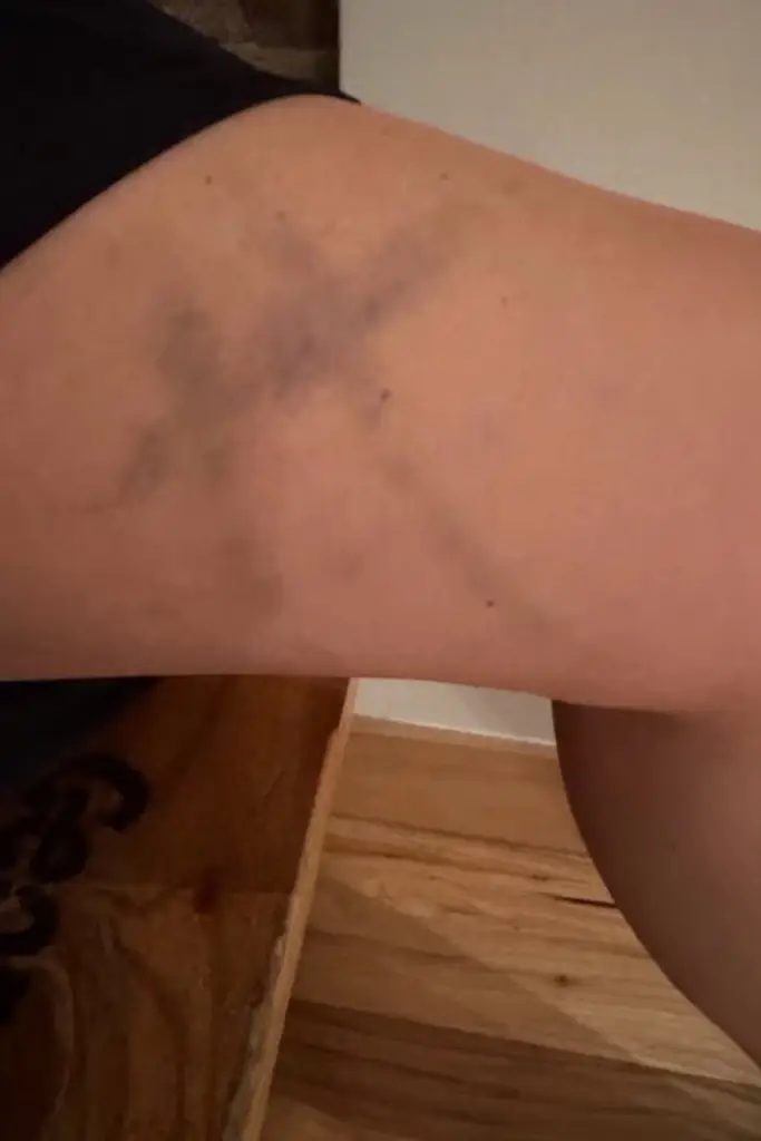 She said events like this aren't usual when filming the franchise (Warner Bros)