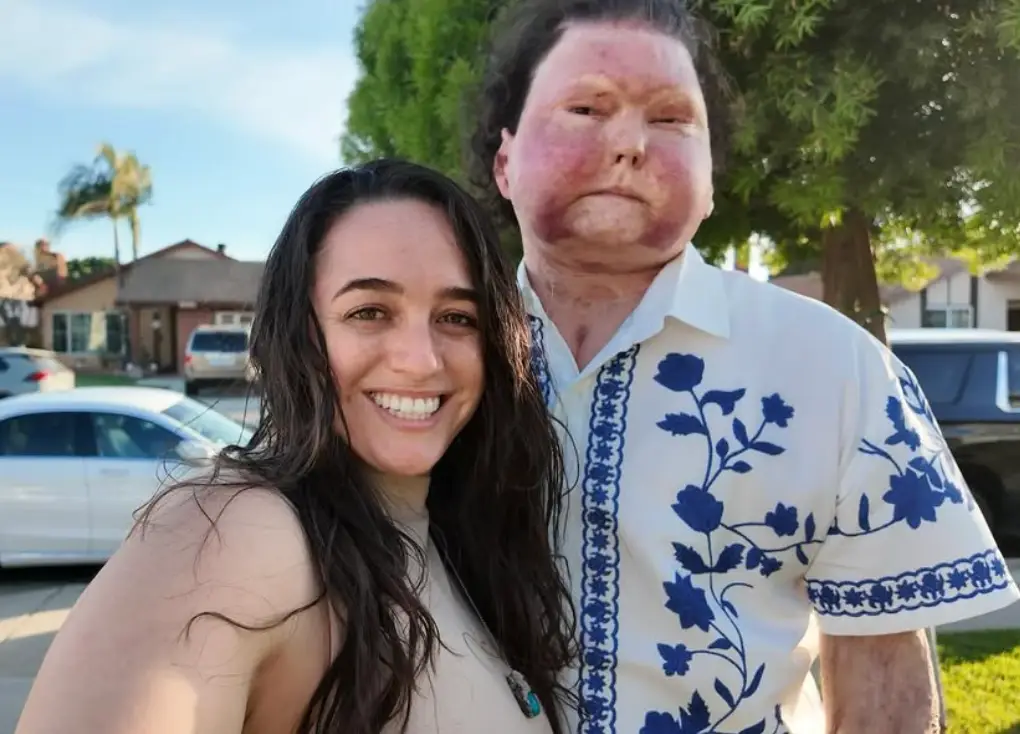 Joe DeMio was the world’s first successful recipient of a face and bilateral hand transplant following a car accident in 2018 (Instagram/@joeroydimeo)