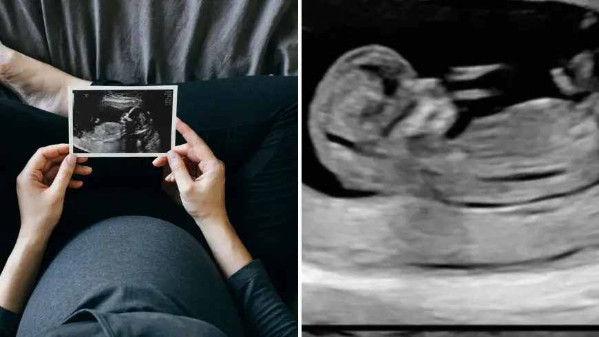 d3sign/Getty Images / Reddit