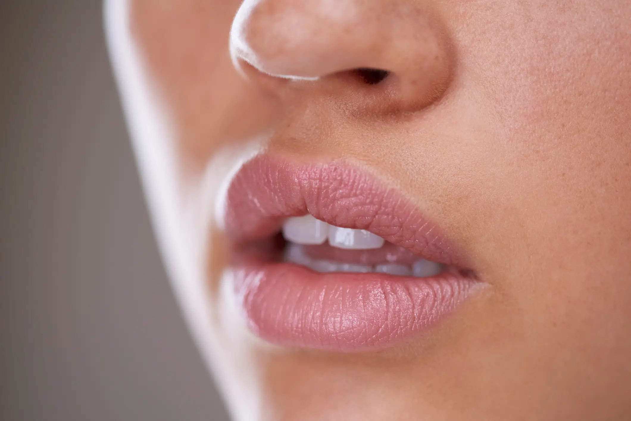 What on earth is 'melasma mouth' and why does it happen to so many women? (Getty Stock Images)