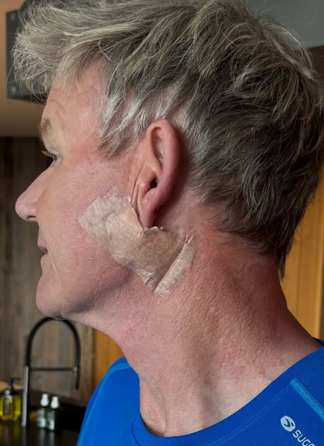 One photo included Ramsay's bandage (Instagram/@gordongram)