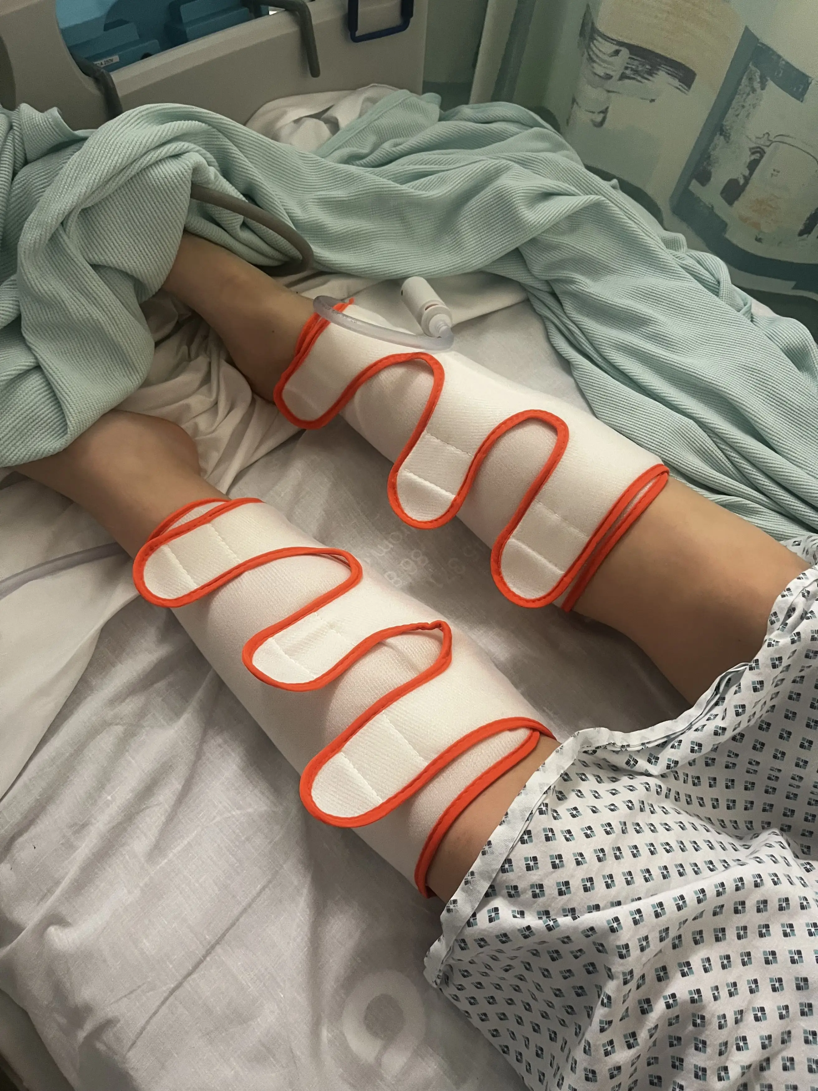 Holly had multiple blood clots in her lungs, stomach and left leg. (Kennedy News and Media)