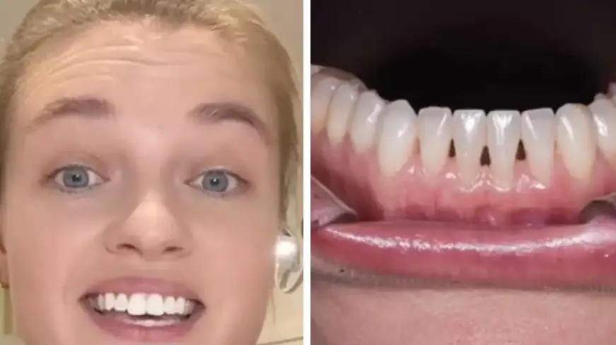 TikTok/@annapetersondental