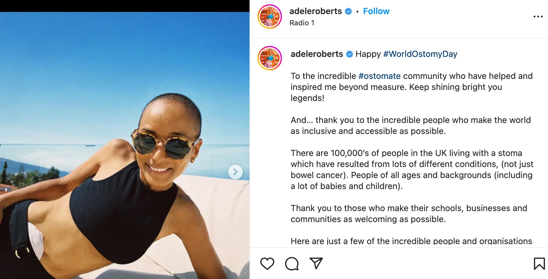 Roberts has opened up about her experience for her followers.