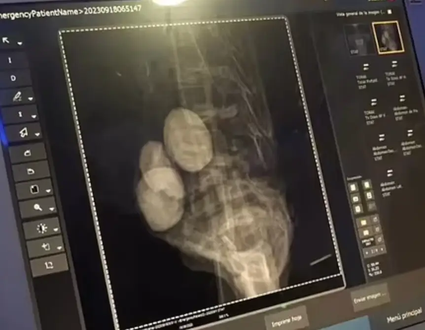 The scientists pointed to lumps in the abdomen which could be 'eggs'.