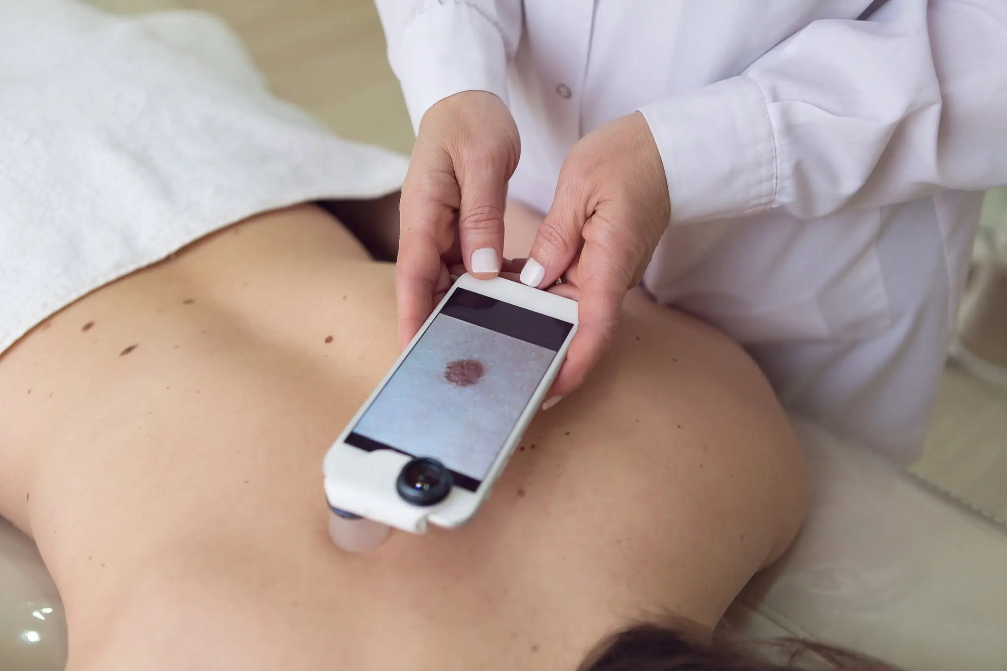 Melanoma can rapidly spread (Getty Stock Image)