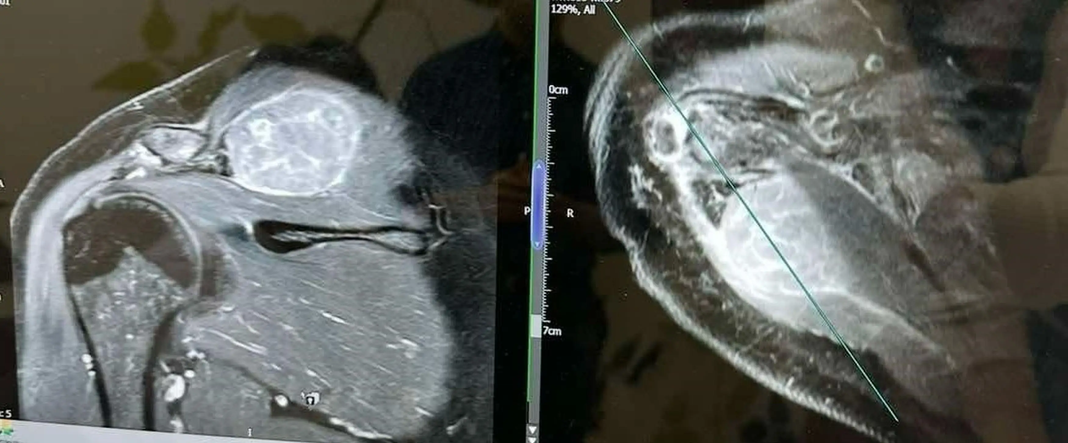 Claire's cancer was diagnosed as stage four (Kennedy News and Media)