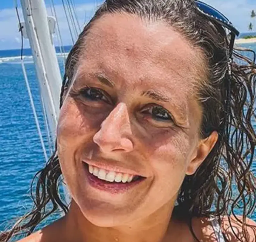 Giulia suffered a 5cm wound to her chest (Instagram/giuliamanfrini)