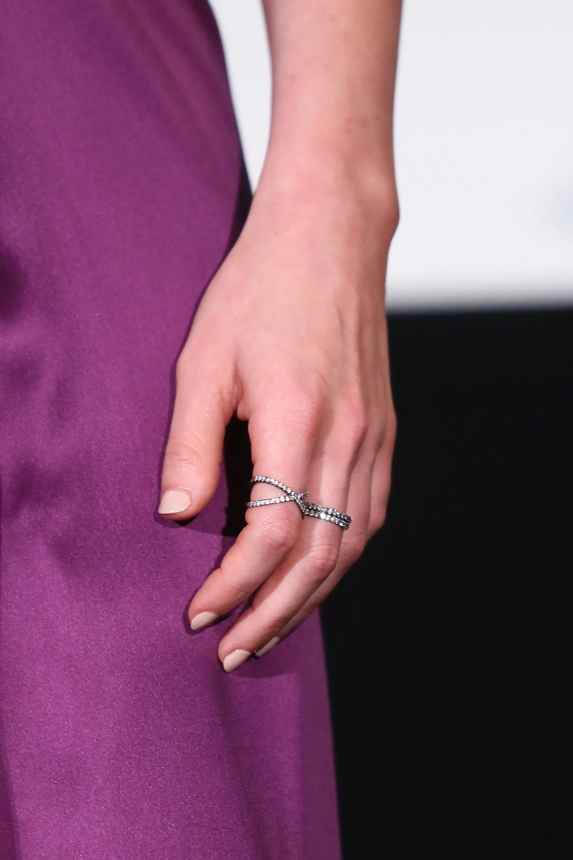 Megan Fox has a condition that impacts the way her thumbs look (Ken Ishii/Getty Images for Paramount Pictures Internationa)