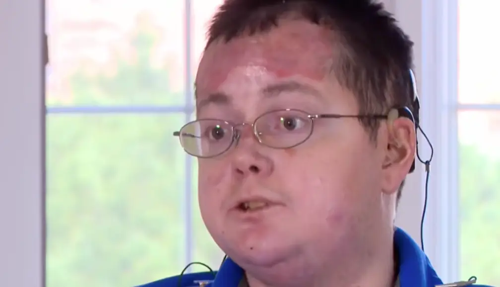 Shane has a rare and incredibly painful disease (Local 12)