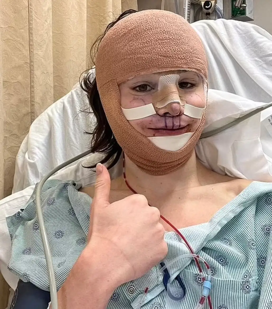 Dylan went under the knife last year.