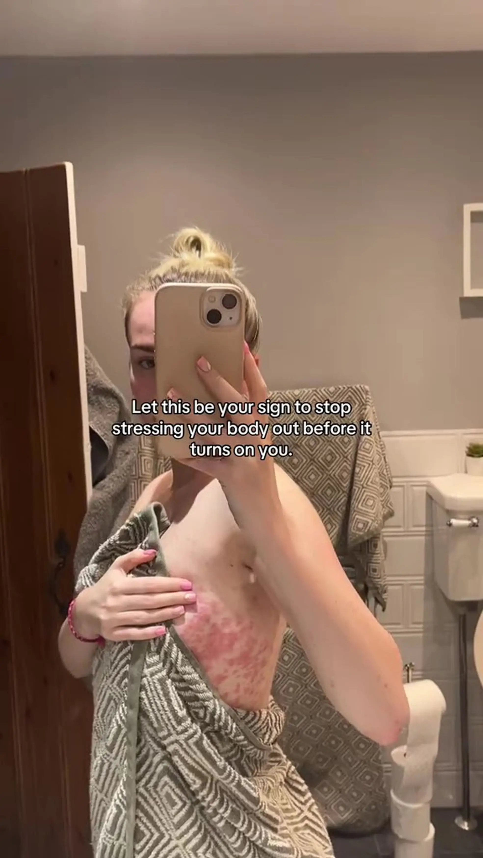 The content creator shared images of her rash online with a warning to others (Kennedy News and Media)