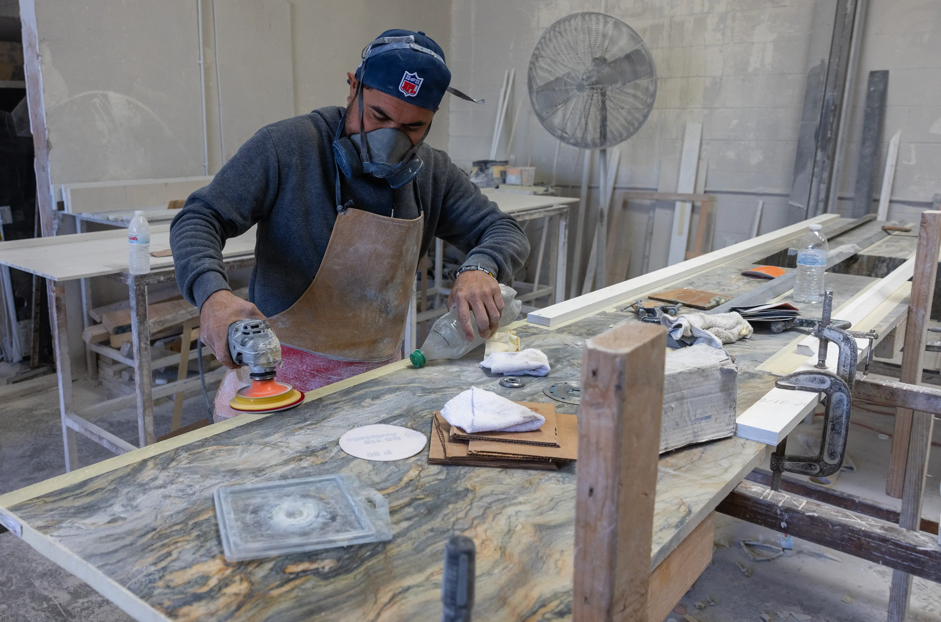 Symptoms of the incurable condition include shortness of breath, fever, and blue skin (Brian van der Brug / Los Angeles Times via Getty Images)