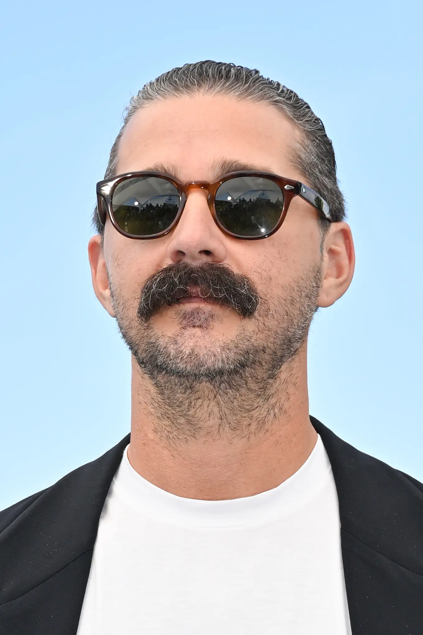 LaBeouf was taken to hospital for the treatment of 'unknown injuries' (Stephane Cardinale - Corbis/Corbis via Getty Images)