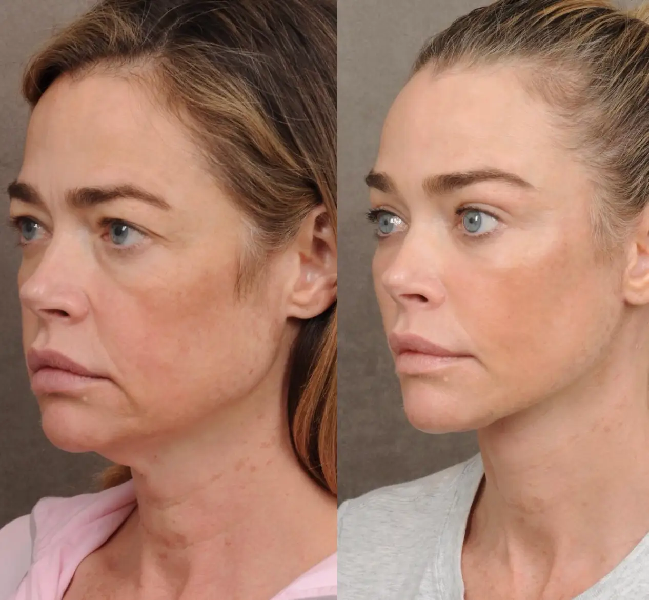 (Instagram/@drbentalei)