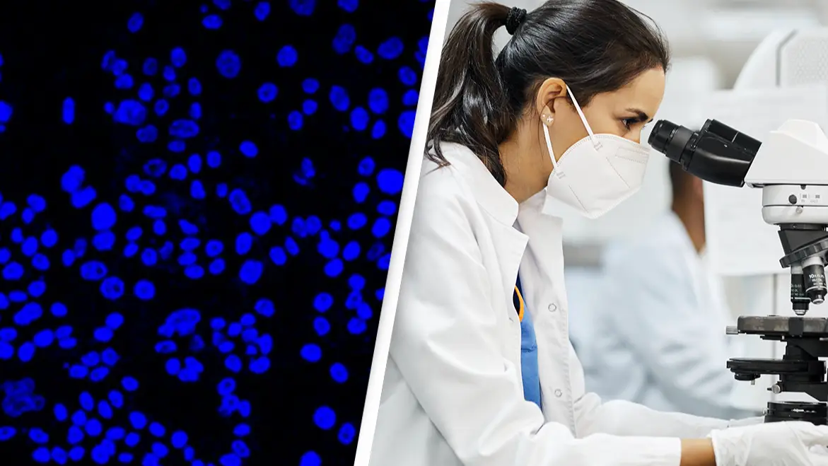 PA/City of Hope/Morsa Images/Getty Images