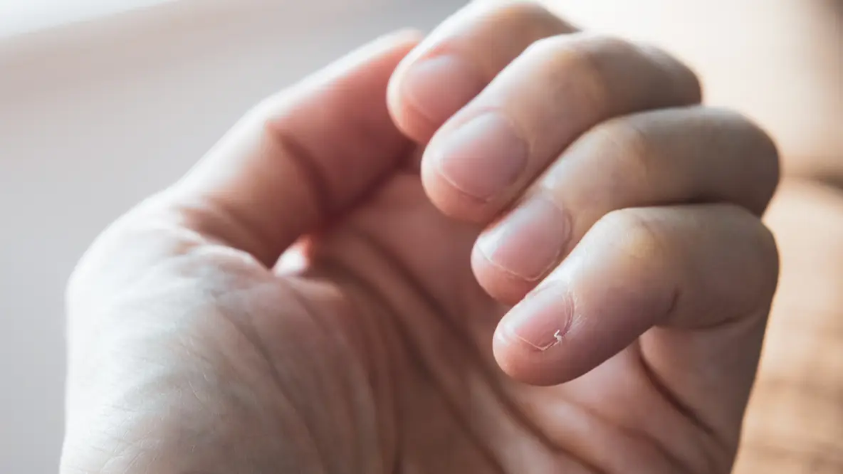 Getty Images/Photographer, Basak Gurbuz Derman