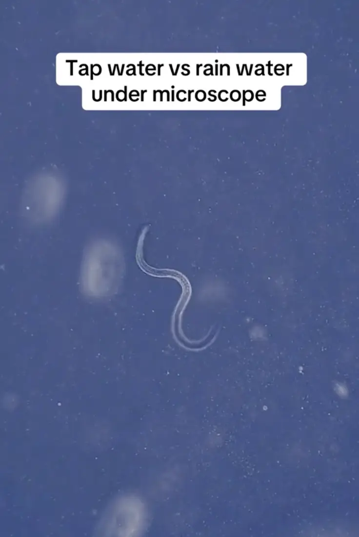 The rain water may have had parasites in it. (microscope.vision/TikTok)