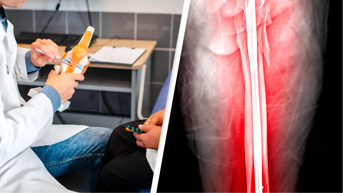 People are paying $150,000 for painful 'leg-lengthening' operations