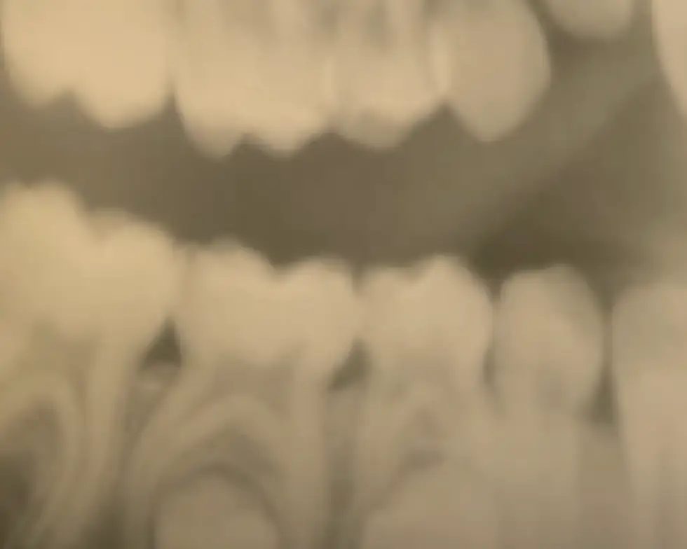 The dentist described the x-ray as 'definitive evidence'.