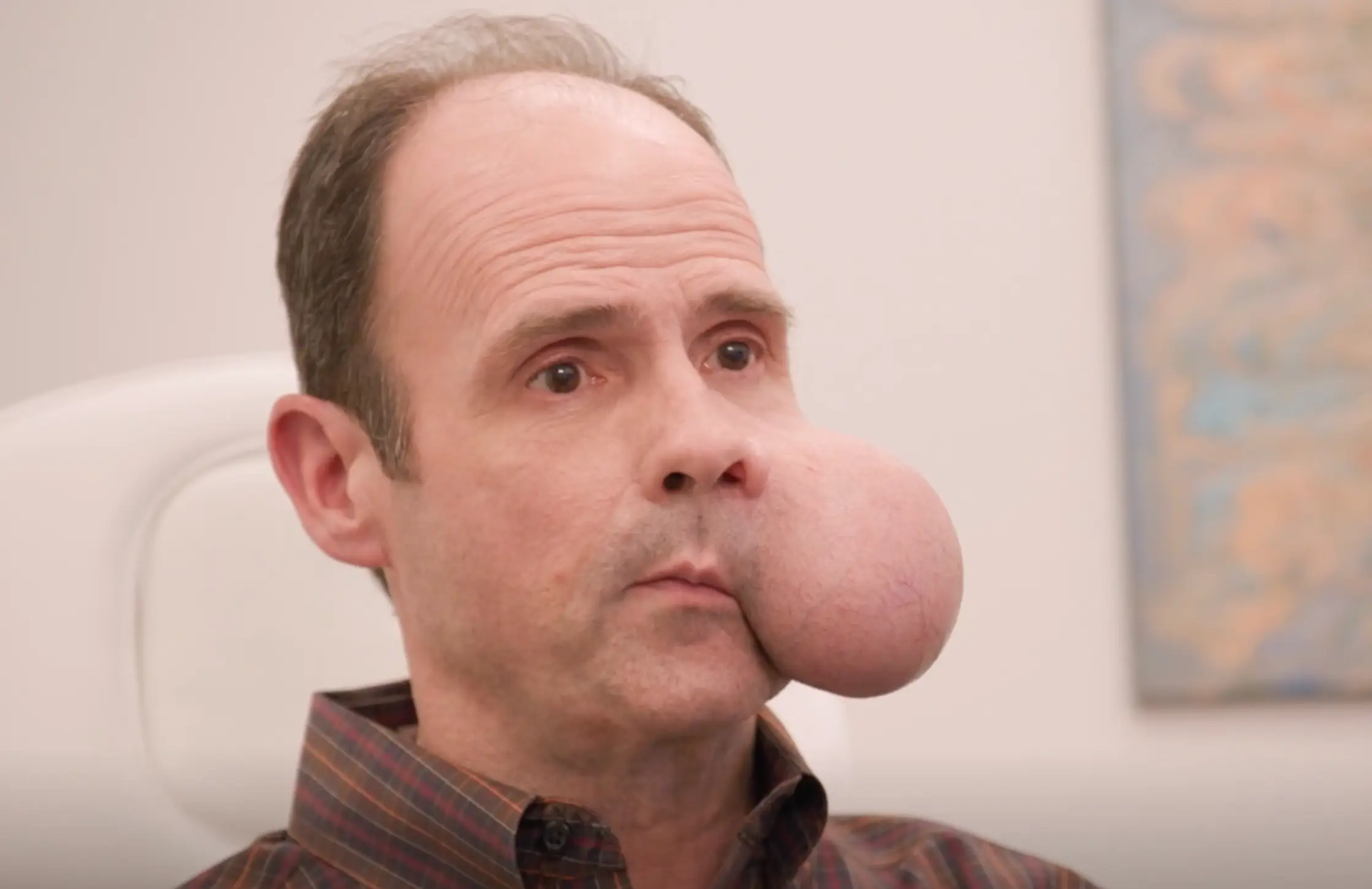 Ron features on TLC's new show 'About Face' (TLC)