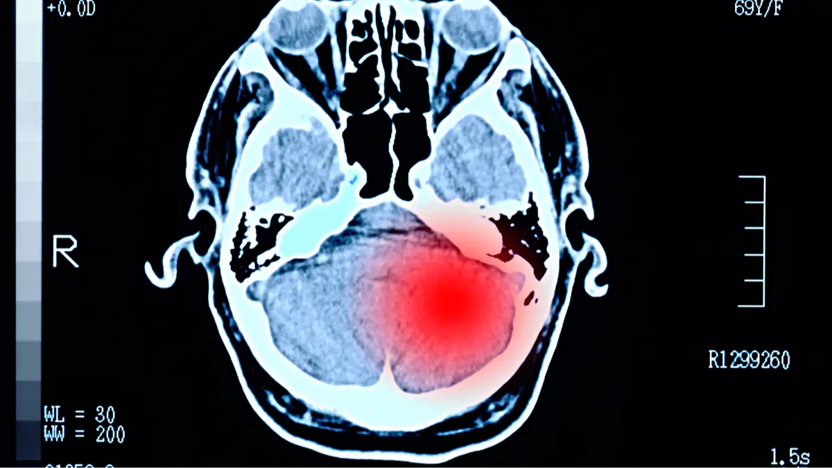 Getty Imgages/Peter Dazeley