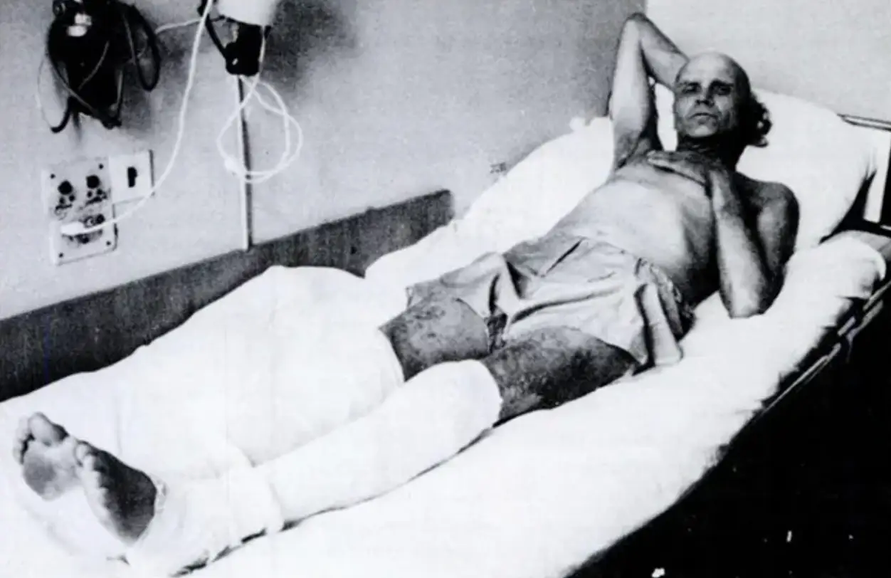 A Chernobyl nuclear engineer who remained on site for four hours, who died despite transplants and transfusions (Photo courtesy Andrew M. Davis, M.D.)