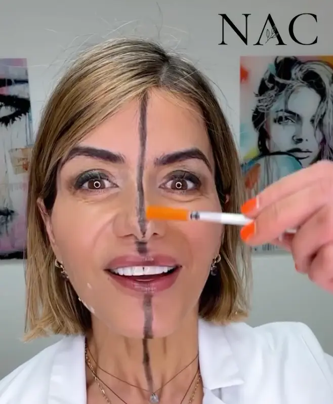 The doctor detailed the results (drbitaaesthetics/Instagram)