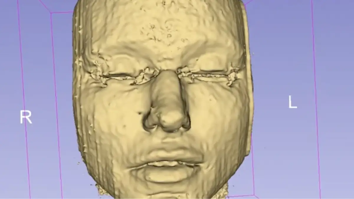 Kami Parsa, M.D. via YouTube