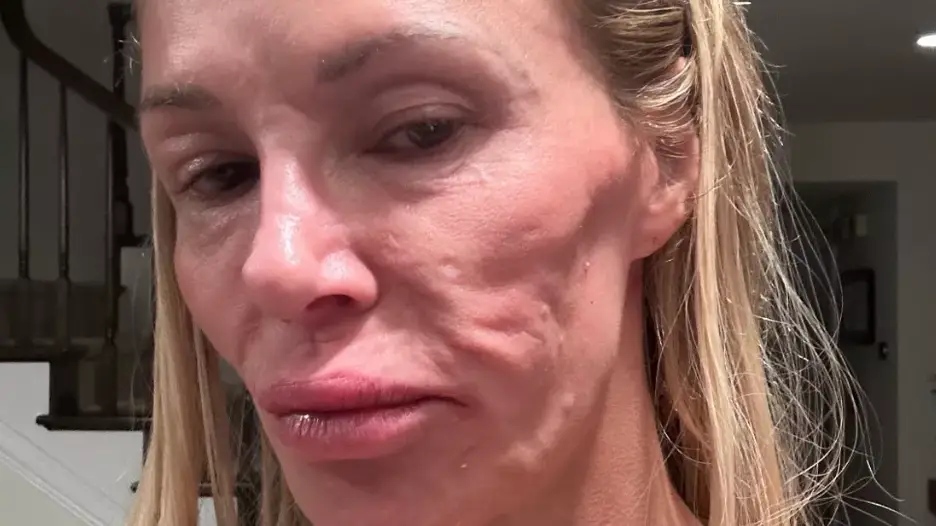Brandi Glanville/X