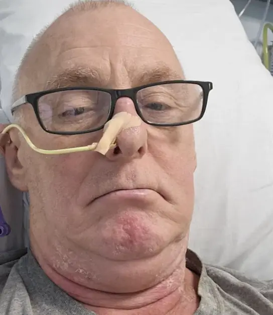 Frank Lane noticed the lump on the right side of his neck (Kennedy News and Media)