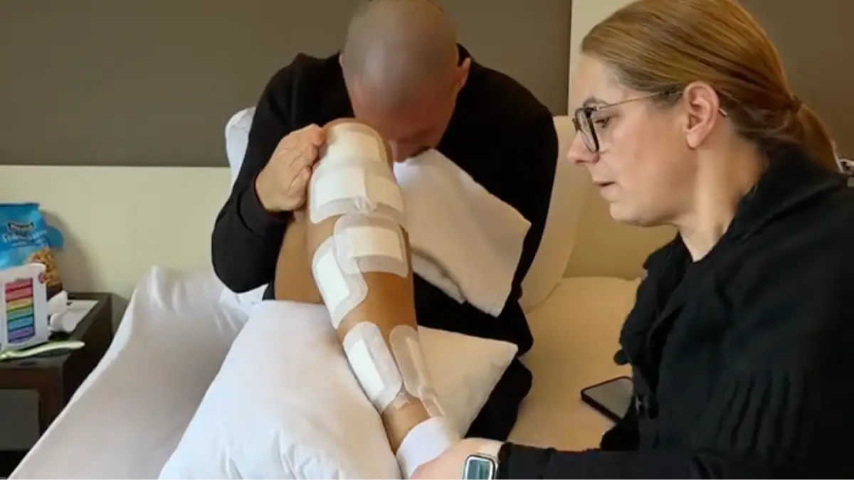 Man who broke his own legs to add 9 inches to his height speaks out on his experience