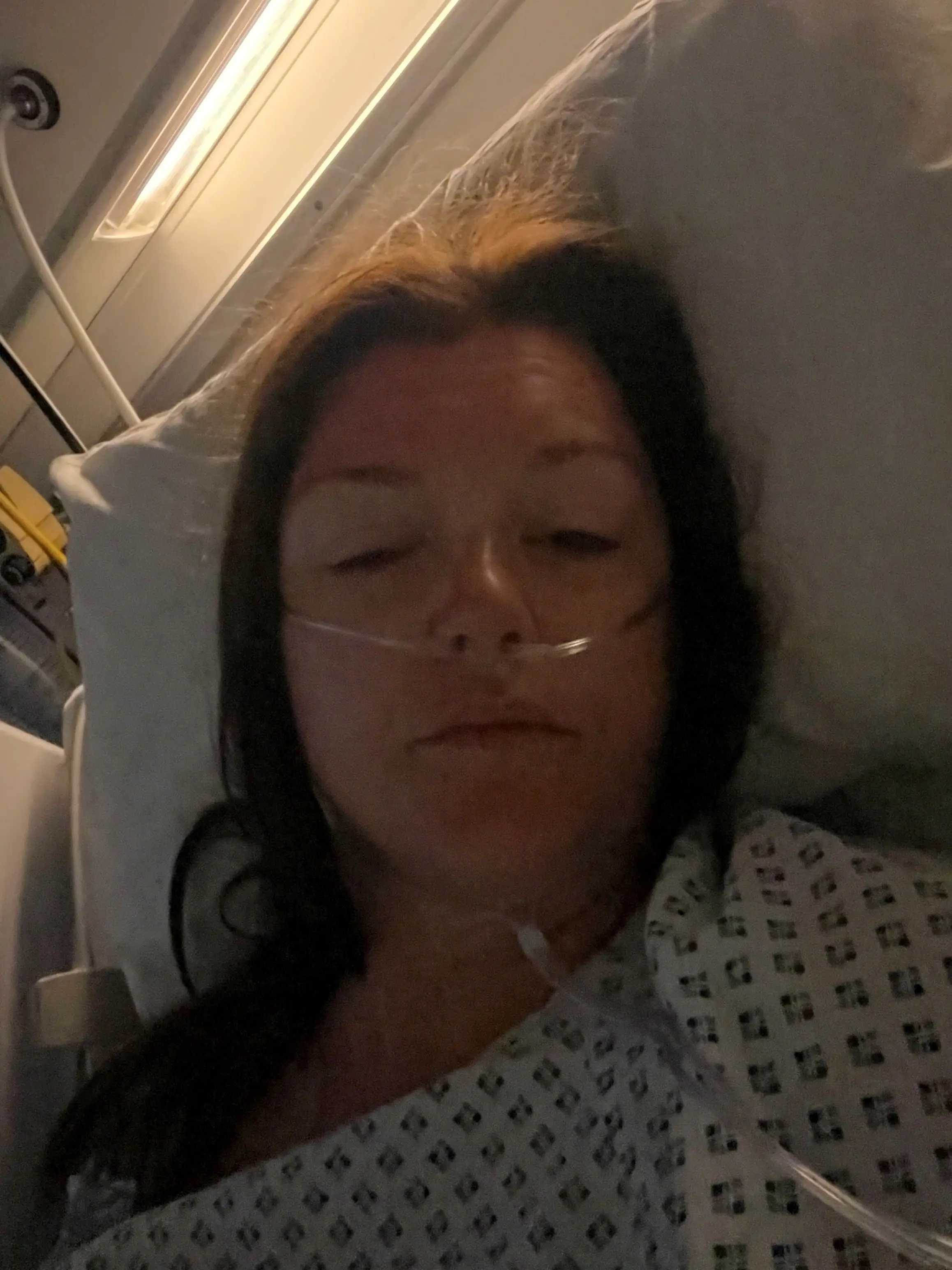 Laura had a third of her bowel removed during surgery (SWNS)