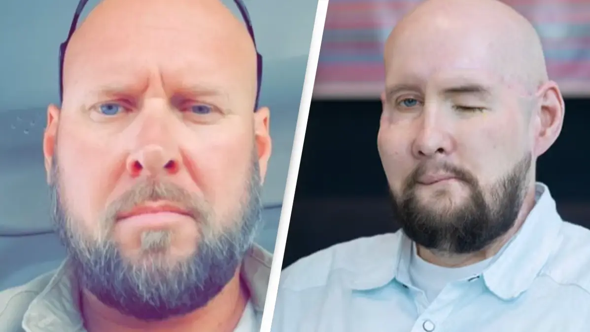 Man who received world-first face and eye transplant opens up about being given a ‘second chance’ at life